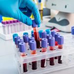 Game-Changer Alert: FDA Greenlights Blood Test to Detect Colon Cancer, Colonoscopies May Become a Thing of the Past