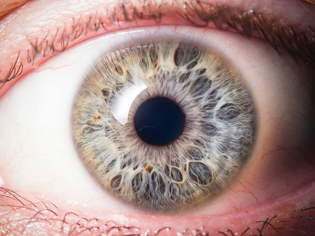 546233284 featured image Close-up of a blue eye with intricate patterns.