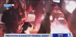 Protester BITES OFF Finger - CHAOS in Minneapolis