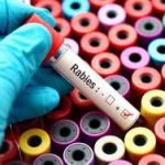 A hand in a blue glove holding a blood test tube labeled Rabies over colorful sample containers