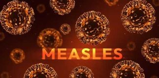Measles Found in California Sewage — Zero Confirmed Human Cases Illustration of measles virus particles with the word 'MEASLES' in bold