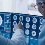 Gas Blast Clears Junk—At What Cost? Doctors reviewing brain MRI scans on multiple monitors