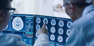 Gas Blast Clears Junk—At What Cost? Doctors reviewing brain MRI scans on multiple monitors